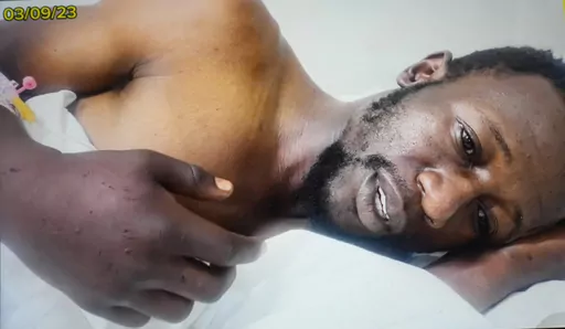 This photo provided by an anonymous source shows local councilor for Zimbabwe's main opposition party, Womberaiishe Nhende lying on a hospital bed in Harare, Sunday Sept. 3, 2023. Barely a week after being elected as a local councilor for Zimbabwe's main opposition party, Womberaiishe Nhende and a relative were pulled out of their car by unidentified men, shot with a stun gun and handcuffed. They were then bundled into a pickup truck and driven about 70 kilometers (more than 40 miles) outside of