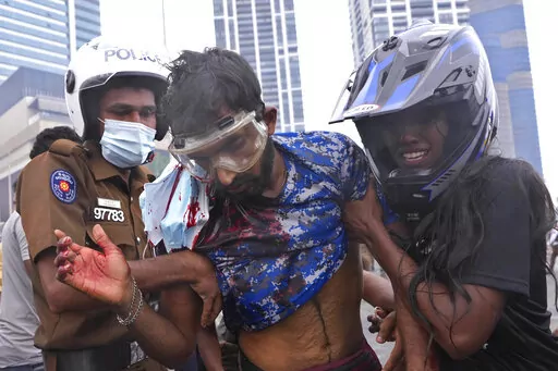 A Sri Lankan policeman, left, and a civilian helps an anti-government protester who was beaten up by government supporters during a clash in Colombo, Sri Lanka, Monday, May 9, 2022. Government supporters on Monday attacked protesters who have been camped outside the offices of Sri Lanka's president and prime minster, as trade unions began a “Week of Protests” demanding the government change and its president to step down over the country’s worst economic crisis in memory. (AP Photo/Eranga 