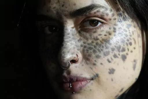 Sonia Sparta poses during a photo shoot for "L'imperfetta (The Imperfect) model agency" in Rome, Tuesday, Feb. 7, 2023. Sonia, who has a rare skin disorder called hyperpigmentation, which produces dark spots on her face and body, is one of the models for L'Imperfetta (The Imperfect) model agency that represents 'extraordinarily imperfect' women and men of all sizes, heights, ages, genders, backgrounds, and disabilities, people who are difficult to classify into the industry's pre-established sta