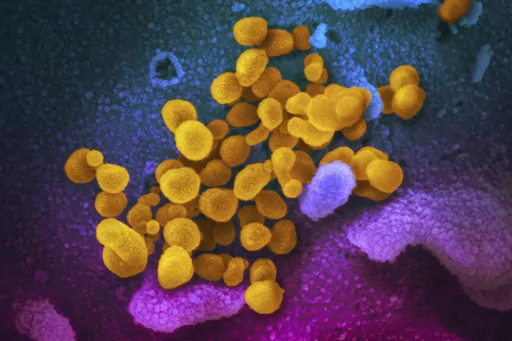 This undated, colorized electron microscope image made available by the U.S. National Institutes of Health in February 2020 shows the Novel Coronavirus SARS-CoV-2, indicated in yellow, emerging from the surface of cells, indicated in blue/pink, cultured in a laboratory. The sample was isolated from a patient in the U.S. There’s less risk of getting long COVID in the omicron era than in the pandemic’s earlier waves, according to a study of nearly 10,000 Americans that aims to help scientists 