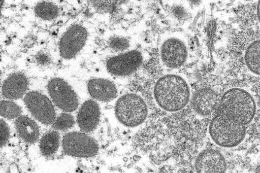 This 2003 electron microscope image made available by the Centers for Disease Control and Prevention shows mature, oval-shaped monkeypox virions, left, and spherical immature virions, right, obtained from a sample of human skin associated with the 2003 prairie dog outbreak. A leading doctor who chairs a World Health Organization expert group described the unprecedented outbreak of the rare disease monkeypox in developed countries as "a random event" that might be explained by risky sexual behavi