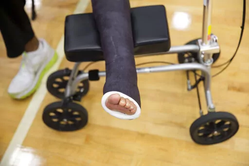 The foot of Georgia State head basketball coach Ron Hunter rests in a cast as he talks to the media, Monday, March 16, 2015, in Atlanta. Hunter torn his Achilles tendon.   New research suggests that surgery may not be needed for most Achilles tendon tears. Doctors have long been divided over whether it’s better to fix a torn Achilles tendon with surgery or just treat it with a brace and physical therapy. In the biggest-ever study investigating which treatment is best, scientists in Norway trac