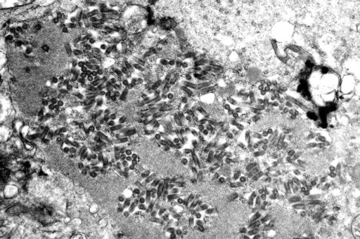 This undated electron microscope image made available by the Centers for Disease Control and Prevention shows rabies virions, dark and bullet-shaped, within an infected tissue sample. Five Americans died of rabies in 2021 — the largest number in a decade — and health officials say some occurred because people didn’t realize they’d been infected or refused life-saving shots. (F. A. Murphy/CDC via AP)